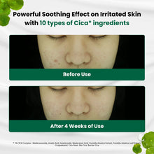 Charger l&#39;image dans la galerie, Dr.G R.E.D Blemish Clear Soothing Cream
