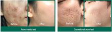Afbeelding in Gallery-weergave laden, SOME BY MI Snail Truecica Miracle Repair Low pH Gel Cleanser
